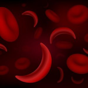 Rockland Wins SBIR Grant for Sickle Cell Disease POC Device
