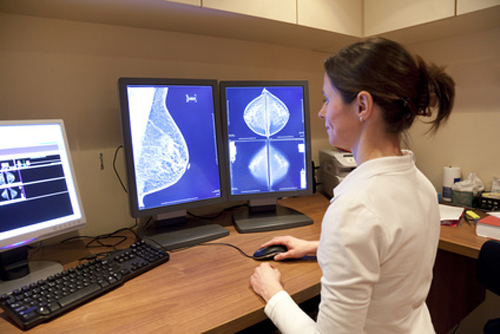 Genomic Wormholes May Be Shortcuts to Breast Cancer