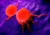 Races Differ in Breast Cancer Chemotherapy Response