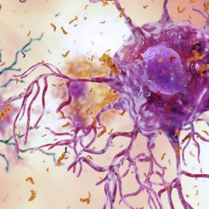 Immune Signalling Molecule Helps Prevent Alzheimer’s Disease Symptoms
