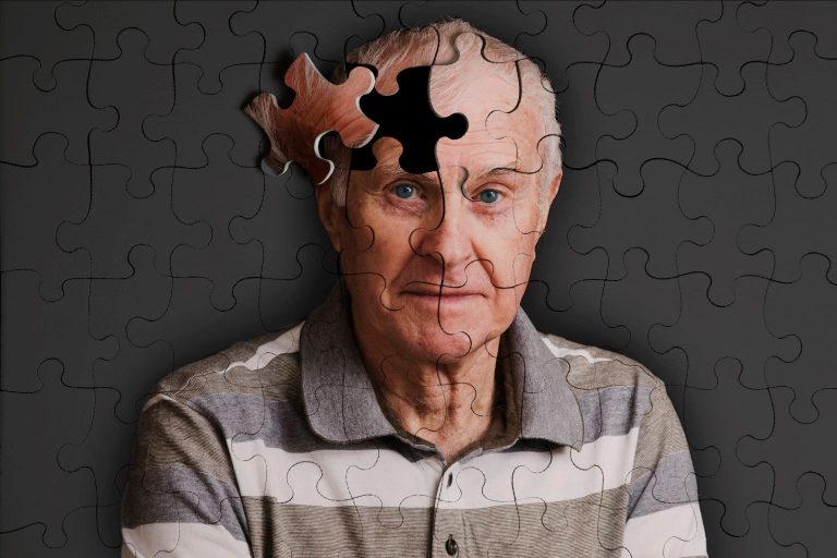 Epigenetic Drivers of Alzheimer’s Disease Identified