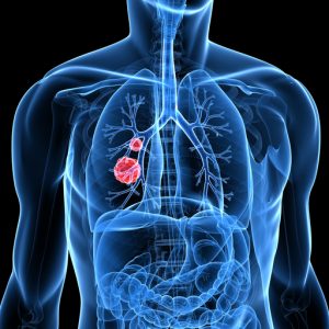 Molecular Testing, Targeted Therapy Guidelines for Lung Cancer Updated by CAP, IASLC, AMP