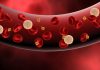 Chilling Platelets Could Considerably Expand Supply to Patients