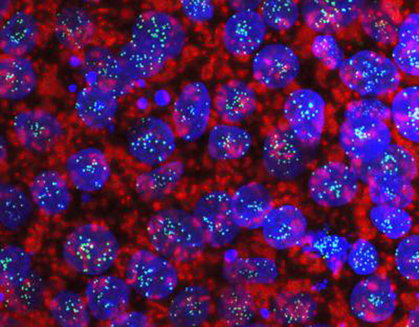 Haploid human embryonic stem cells created at the Hebrew University's Azrieli Center for Stem Cells and Genetic Research. [Hebrew University of Jerusalem]