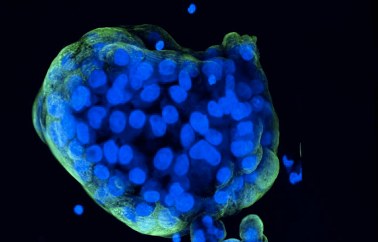 SEngine uses 3D cancer cell organoids grown from patient tumor samples to test more than a hundred drugs at once for efficacy against each patient's unique cancer. Source: SEngine