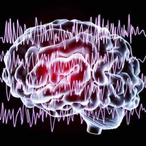 Genetic Testing Helps Improve Outcomes in Epilepsy Patients