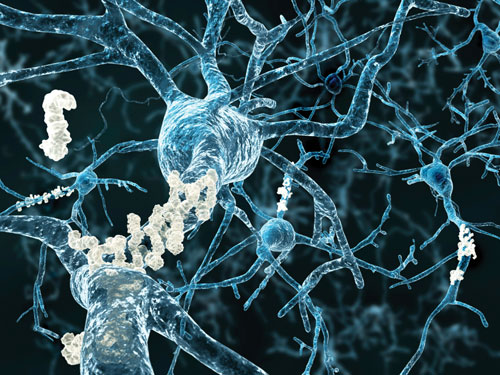 A team of researchers has concluded that the MAP2K3 gene could prove to be a promising target for new drugs that reduce age-related memory decline—and possibly