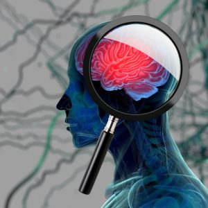 AI Speech Analysis Could Spot Early Alzheimer’s