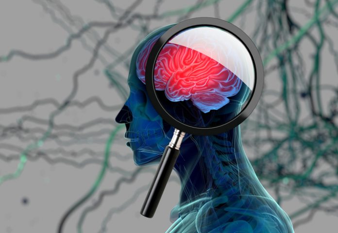 3D medical background with interconnecting green and grey lines. In foreground there is an illustration of a human head with a magnifying glass examining the brain depicting alzheimer's disease research.