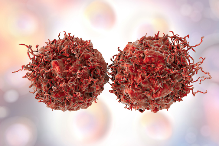 Prostate cancer cells, illustration