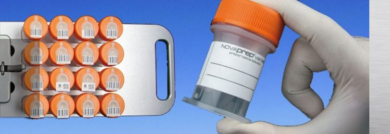 Novacyt to Sell NOVAprep Cytology Solution, Clinical Lab Businesses