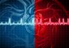 ACC and AHA Issue New Guideline for Preventing and Optimally Managing Atrial Fibrillation