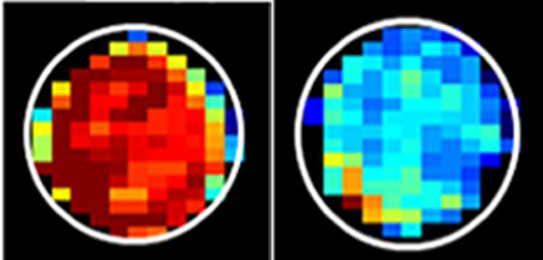 A new MRI technique shows that mucin-attached sugars generate a high MRI signal (left) compared to cancerous cells (right) [Xiaolei Song/Johns Hopkins Medicine]
