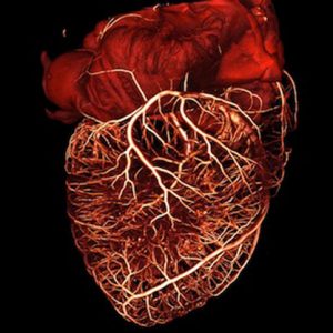 Congenital Heart Disease and Neurodevelopment Mutations Linked