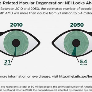 Massive Genetic Analysis Study Finds Drivers of Age-Related Macular Degeneration