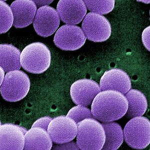 Fast Test for Antibiotic Susceptibility Developed