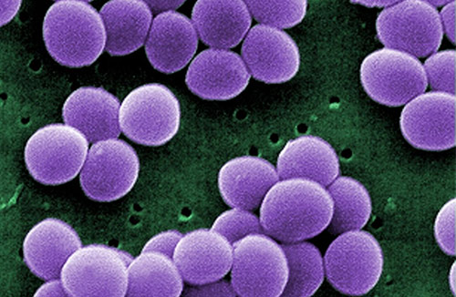 Staphylococcus aureus bacteria [CDC/DRPH]