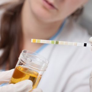 Trovagene, Dana Farber to Test Urine-Based Cancer Mutation Tracking