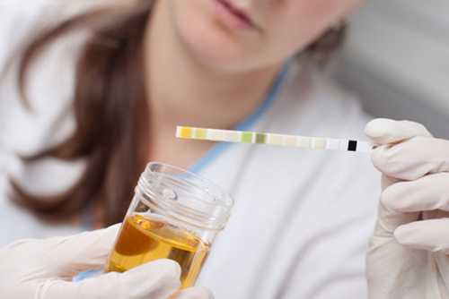 Trovagene, Dana Farber to Test Urine-Based Cancer Mutation Tracking