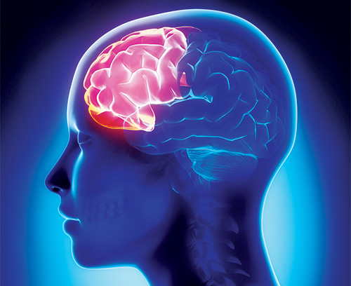 Illustration of woman's head showing front part of brain lit up to symbolize problems in the prefrontal cortex