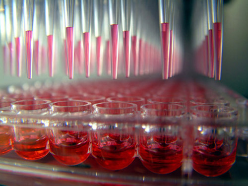 A recent report estimates the global demand for PCR technologies in 2013 to be around $10.6 billion. [Caleb Foster - Fotolia.com]