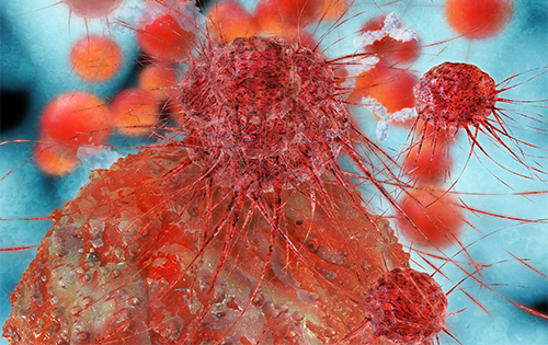Cancer cells - 3d rendered illustration