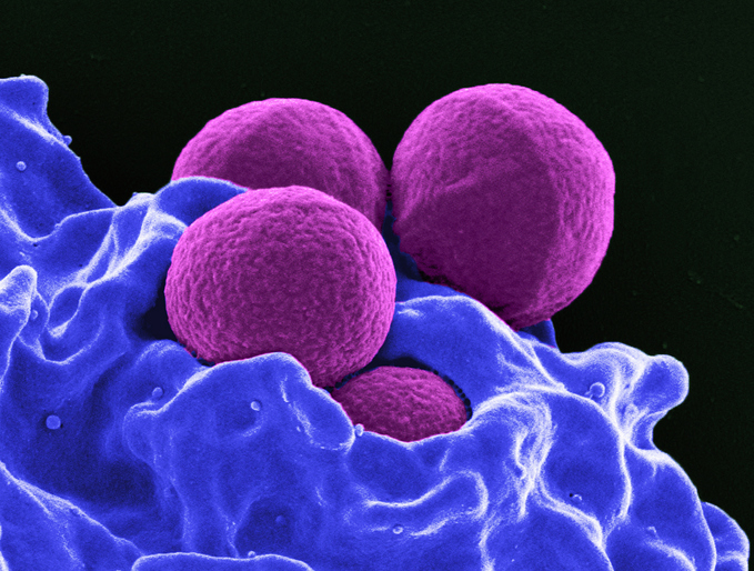 Colorized SEM of four spherical methicillin-resistant Staphylococcus aureus (MRSA) bacteria (purple) in the process of being phagocytized by a human neutrophil white blood cell (blue)