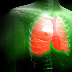 SQI Diagnostics Partners with UHN on Diagnostic for Lung Transplantation
