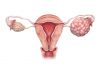 Machine Learning Aids Detection of Cancerous Ovarian Lesions