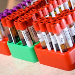 Genomics England Reports Positive First Phase of Cancer ctDNA Study