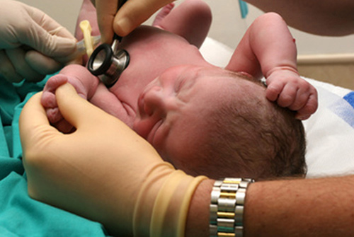 Gene Expression Signature in Blood Can Diagnose Brain Damage in Newborn Babies