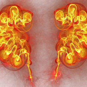Novel Organoid Shows Kidney Tumors in TSC Follow Multiple Paths