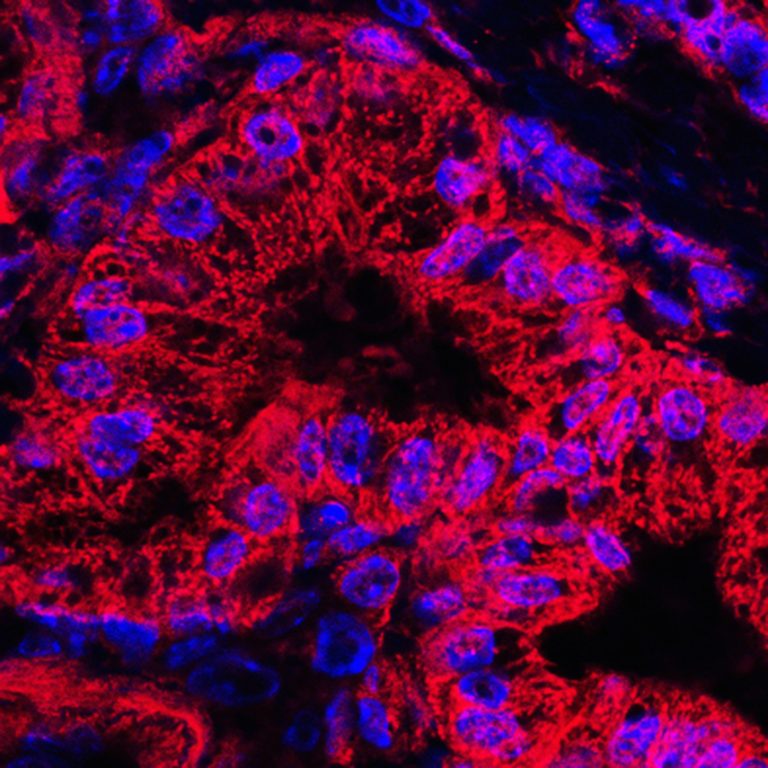 Microscopic image of mitochondrial stained pancreatic cancer cells
