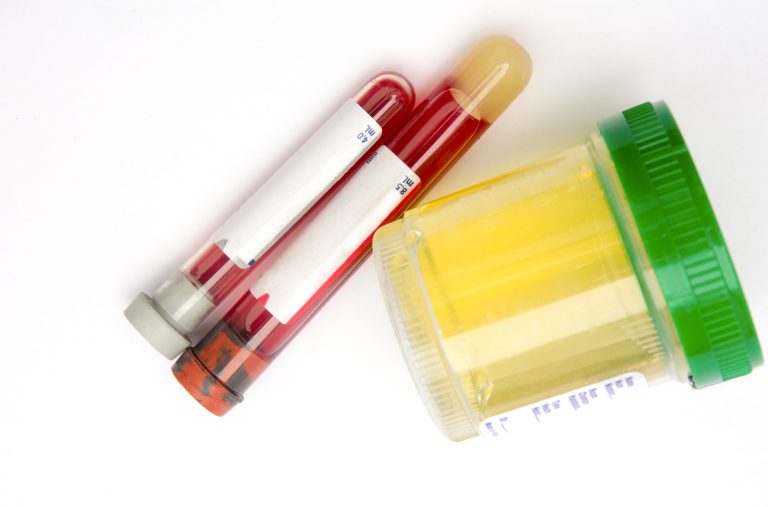 Urine Better than Blood for Determining Bladder Cancer Genomic Profile