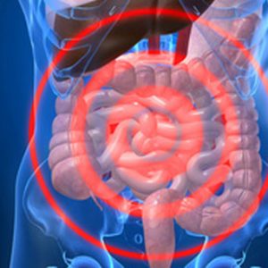 Artificial Intelligence Can Help Improve Bowel Cancer Treatment