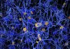 Study Reveals How Microglia Contribute to Alzheimer’s Disease