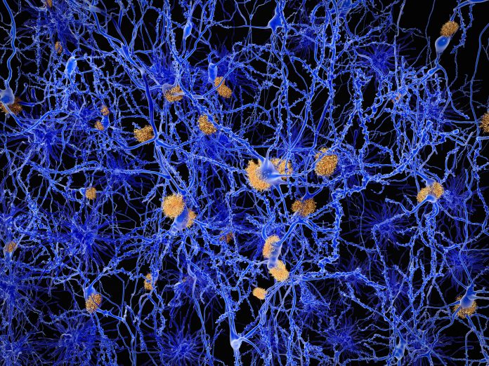 Image showing microglia in the brain illustrating Alzheimer´s Disease