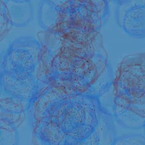 Indivumed Cancer Database to Add Proteomic Data Via Biognosys Collaboration