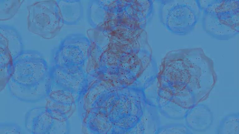 Indivumed Cancer Database to Add Proteomic Data Via Biognosys Collaboration