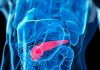 Key Protein In Pancreatic Cancer Growth and Spread Found