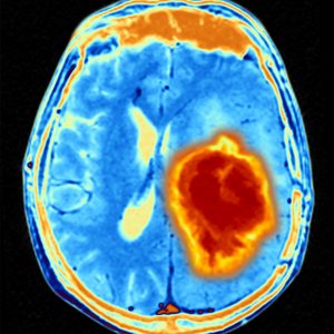 Imaging Plus Deep Molecular Analysis Improves Precision Cancer Treatment