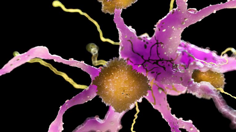 Researchers Detail Mechanism for Clearing Misfolded Proteins at Root of Alzheimer’s Disease