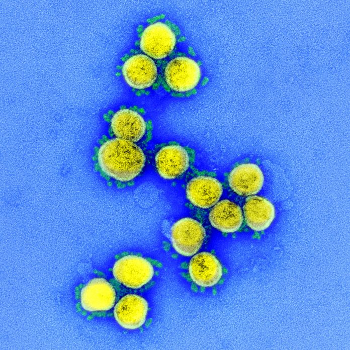SARS-CoV-2 antibiodies