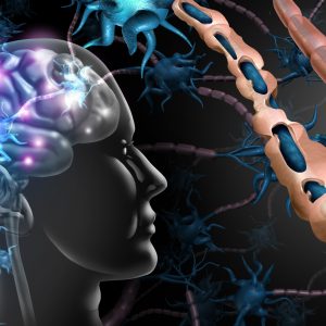 Gene Expression Study Highlights Three Genes Linked with Multiple Sclerosis