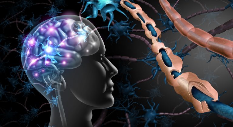 Four New Autoantigens Linked With Multiple Sclerosis Identified