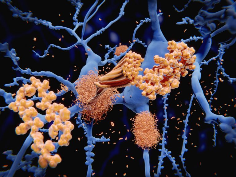 Potential Target for Alzheimer’s Treatment Found in Methylation of Messenger RNA