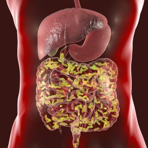 Gut Microbiome Can Trigger Sickle Cell Disease Complications