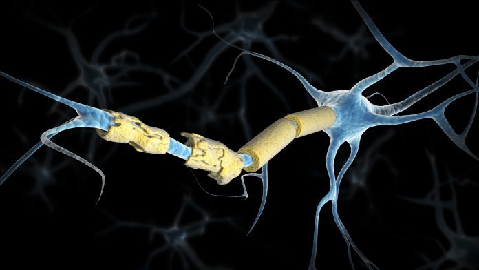 Conceptual image of a multiple sclerosis neuron.