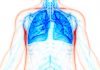 Lung Cell Therapy Shows Promise for Treating COPD