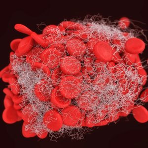 Autoantibodies in COVID-19 Promote Blood Clots